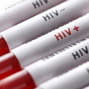 بیماری ایدز در ایران چقدر قربانی می‌گیرد؟
